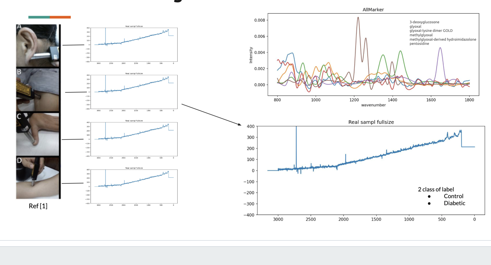 Diabetes Classification using Raman Spectrums